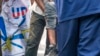 Un homme est blessé à la jambe lors d'une manifestation où des manifestants et des policiers se sont affrontés à Kinshasa le 9 juillet 2020 lors de manifestations organisées contre l'UDPS), pour la nomination du nouveau président de la Commission électorale. (AFP/Arsene Mpiana)