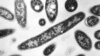 FILE - This 1978 electron microscope image made available by the Centers for Disease Control and Prevention shows Legionella pneumophila bacteria, which are responsible for causing the pneumonic disease Legionnaires' disease. 