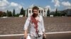 An injured man walks off the site of a missile strike near the Taras Shevchenko Chernihiv Regional Academic Music and Drama Theatre in Chernihiv, Ukraine, Aug. 19, 2023. 