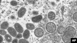 This 2003 electron microscope image made available by the Centers for Disease Control and Prevention shows mature, oval-shaped monkeypox virus. 