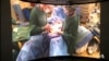 Virtual Reality Applications in Medicine, Security on Horizon